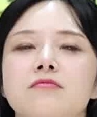 Face