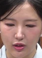 Face