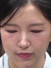 Face