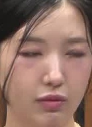 Face