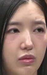 Face