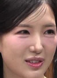 Face