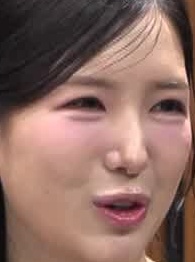 Face