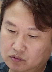 Face