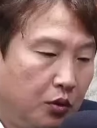 Face