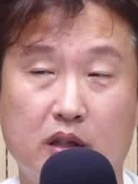 Face