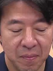 Face