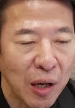 Face