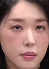 Face