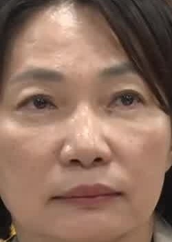 Face