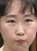 Face