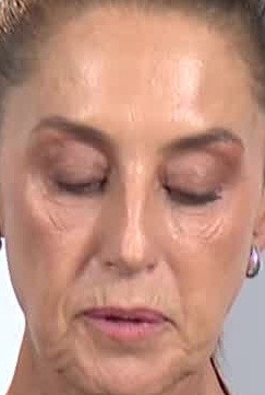 Face