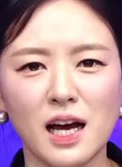 Face