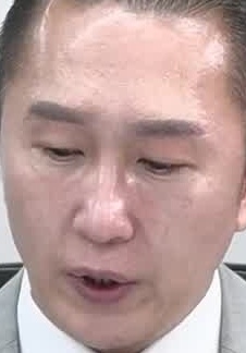 Face