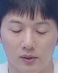 Face