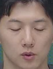 Face