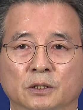 Face