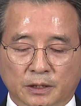 Face