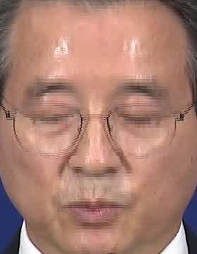 Face