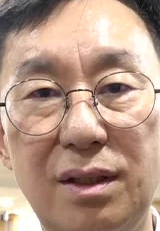 Face