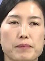 Face