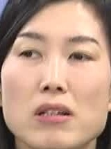 Face