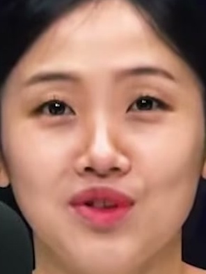 Face