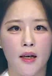 Face
