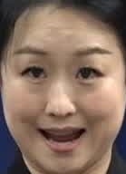 Face