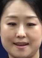 Face