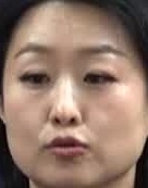Face