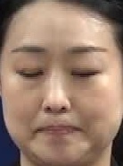 Face