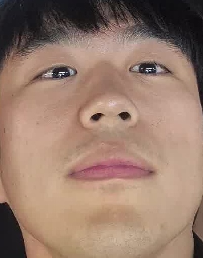 Face