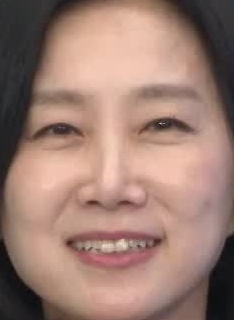 Face