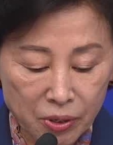 Face