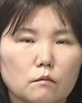 Face