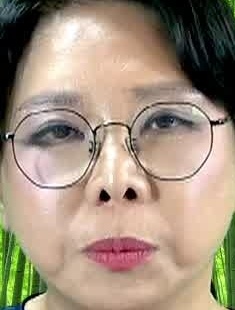 Face