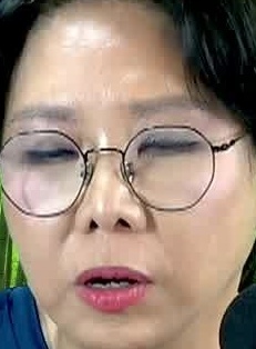 Face