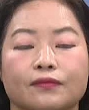 Face