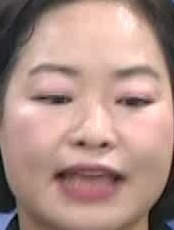Face