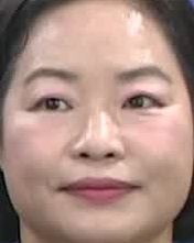 Face