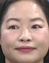 Face