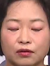 Face