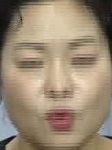 Face