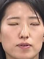 Face