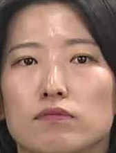 Face