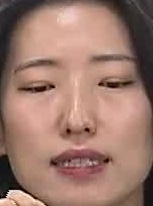 Face