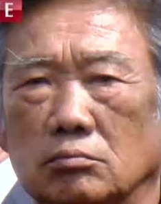 Face