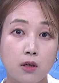 Face