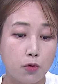 Face